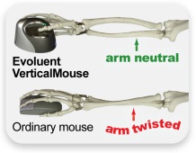 Arm and bone positioning when using a desk mouse