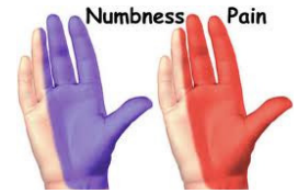 Hand numbness and pain image